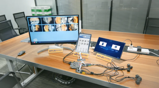 rk3576开发板三屏异显